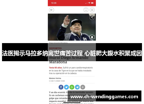 法医揭示马拉多纳离世痛苦过程 心脏肥大腹水积聚成因